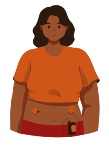 Woman with Insulin Pump